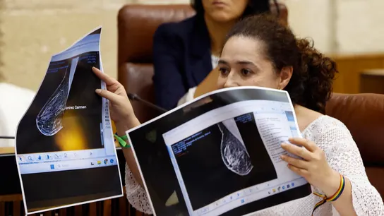 La teta de Anabel señala a Moreno: una diputada de Por Andalucía muestra una mamografía presuntamente manipulada La teta de Anabel señala a Moreno: una diputada de Por Andalucía muestra una mamografía presuntamente manipulada