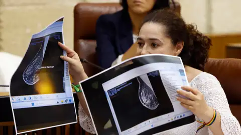 La teta de Anabel señala a Moreno: una diputada de Por Andalucía muestra una mamografía presuntamente manipulada La teta de Anabel señala a Moreno: una diputada de Por Andalucía muestra una mamografía presuntamente manipulada