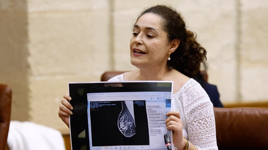 Inmaculada Nieto, portavoz de Por Andalucía, muestra dos mamografías de la misma mujer en el Parlamento andaluz Inmaculada Nieto, portavoz de Por Andalucía, muestra dos mamografías de la misma mujer en el Parlamento andaluz