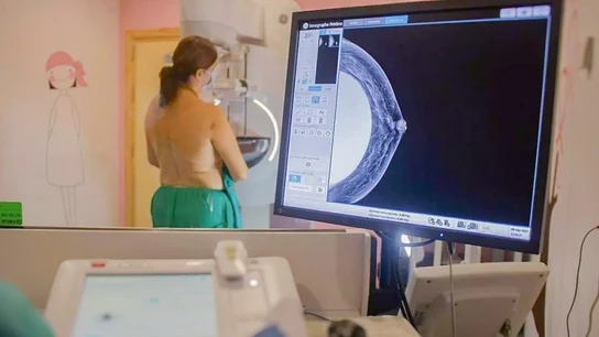 Una mujer se realiza una mamografía Una mujer se realiza una mamografía