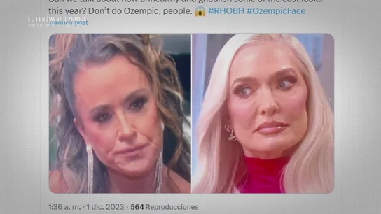 La cara Ozempic’: el efecto secundario que te descuelga el rostro tras perder peso en tiempo récord La cara Ozempic’: el efecto secundario que te descuelga el rostro tras perder peso en tiempo récord