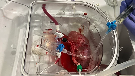 Un riñón porcino conectado a la máquina de 'perfusión normotérmica', un dispositivo que sirve para preservar el riñón vivo y oxigenado de manera ex vivo (fuera del cuerpo) Un riñón porcino conectado a la máquina de 'perfusión normotérmica', un dispositivo que sirve para preservar el riñón vivo y oxigenado de manera ex vivo (fuera del cuerpo)