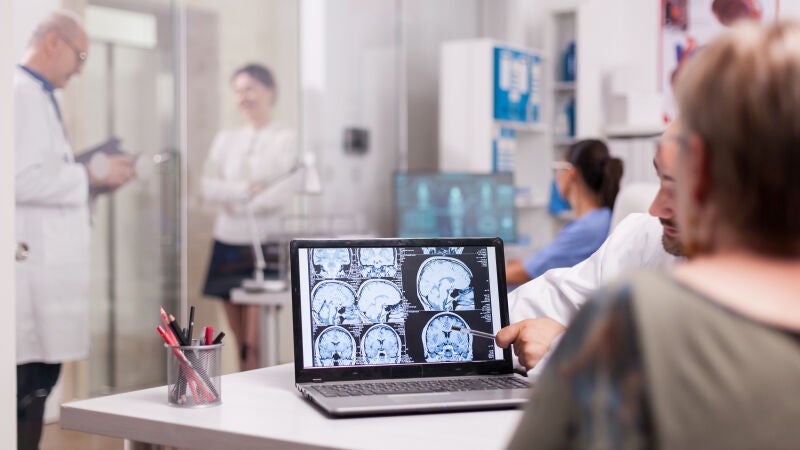 La Inteligencia Artificial, clave en los avances de la esclerosis múltiple