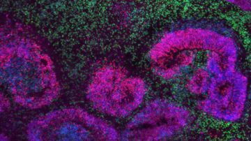 Organoide cortical humano de 8 semanas con estructuras en roseta (rosa y azul) rodeadas de neuronas (verde) Organoide cortical humano de 8 semanas con estructuras en roseta (rosa y azul) rodeadas de neuronas (verde)