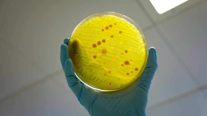Un estudio revela cómo las bacterias logran resistir a los antibióticos