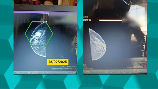 El testimonio de Elena, afectada por un fallo en los cribados en Murcia: "Le tengo que dar gracias a mi neumonía" El testimonio de Elena, afectada por un fallo en los cribados en Murcia: "Le tengo que dar gracias a mi neumonía"