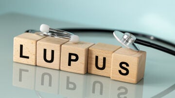 Lupus