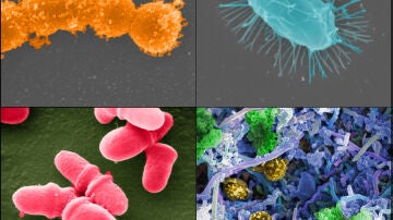Diversas bacterias de nuestra microbiota Diversas bacterias de nuestra microbiota