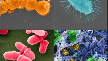Diversas bacterias de nuestra microbiota Diversas bacterias de nuestra microbiota
