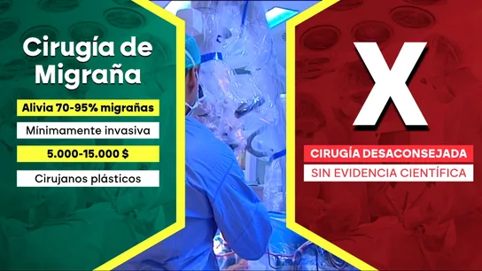 Grafismo acerca de la cirugía de migrañas Grafismo acerca de la cirugía de migrañas
