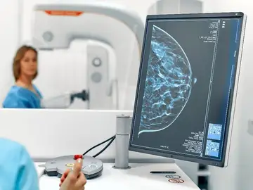 Mamografía Mamografía