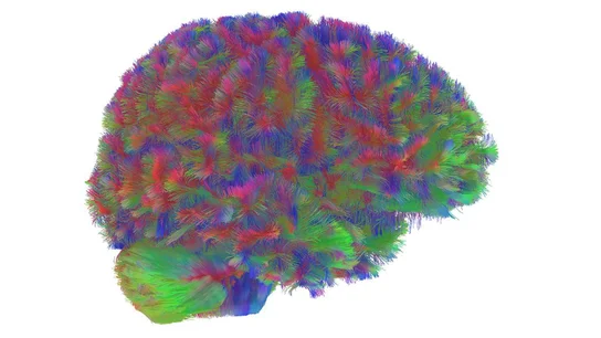Imagen representativa de una resonancia magnética de la primera etapa del cerebro humano Imagen representativa de una resonancia magnética de la primera etapa del cerebro humano