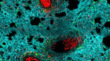 Neutrófilos en el pulmón Neutrófilos en el pulmón