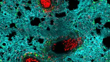 Neutrófilos en el pulmón Neutrófilos en el pulmón