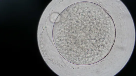 Fotografía de archivo de un óvulo. Fotografía de archivo de un óvulo.