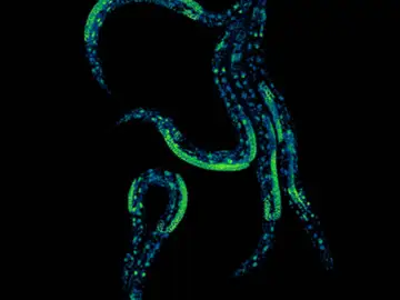 Cinco Caenorhabditis elegans tomada en los laboratorios de investigación del CRG Cinco Caenorhabditis elegans tomada en los laboratorios de investigación del CRG