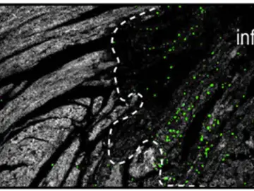 Neutrófilos Neutrófilos
