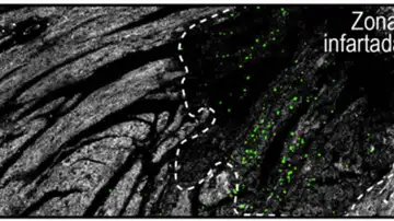 Neutrófilos Neutrófilos