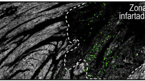 Neutrófilos Neutrófilos