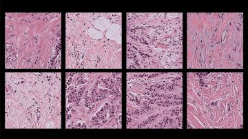 Im&aacute;genes patol&oacute;gicas de muestras de tejido humano