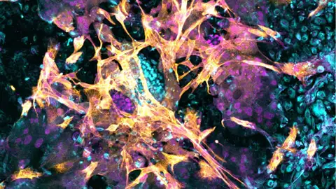 Imagen microscópica de un embrión humano de 14 días que se ha implantado en el nuevo modelo endometrial Imagen microscópica de un embrión humano de 14 días que se ha implantado en el nuevo modelo endometrial