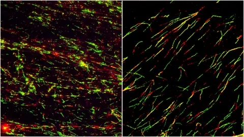 En la imagen de la izquierda se ve las lineas celulares con las proteínas alteradas que se reproducen de forma descontrolada. En la de la derecha, una vez restablecido el orden En la imagen de la izquierda se ve las lineas celulares con las proteínas alteradas que se reproducen de forma descontrolada. En la de la derecha, una vez restablecido el orden