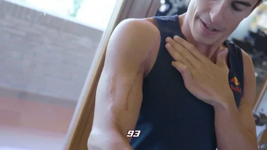 Marc Márquez explica cómo se encuentra su cuerpo después de sus múltiples lesiones: "Convivo con ellas" Marc Márquez explica cómo se encuentra su cuerpo después de sus múltiples lesiones: "Convivo con ellas"
