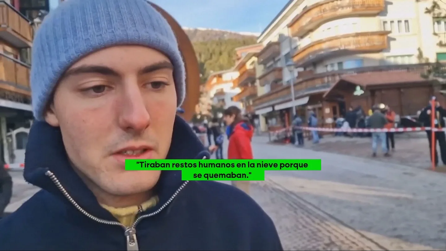 Uno de los supervivientes en el trágico incendio de un bar en Suiza. Uno de los supervivientes en el trágico incendio de un bar en Suiza.