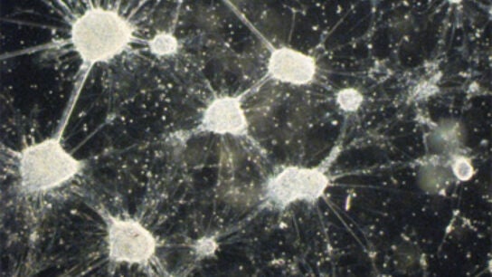 Las neuronas dopamin&eacute;rgicas. 