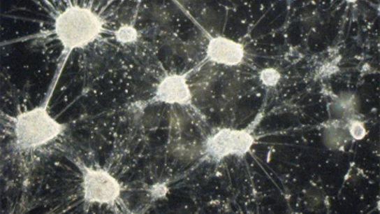 Las neuronas dopaminérgicas. Las neuronas dopaminérgicas.