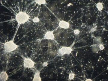 Las neuronas dopamin&eacute;rgicas. 