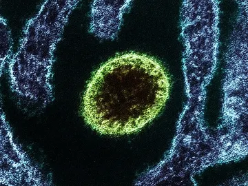 Virus Nipah Virus Nipah