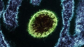 Virus Nipah