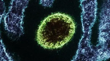 Virus Nipah Virus Nipah