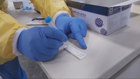 Por qué hay más sarampión: de 2 casos en 2021 a casi 400 en 2025 Por qué hay más sarampión: de 2 casos en 2021 a casi 400 en 2025