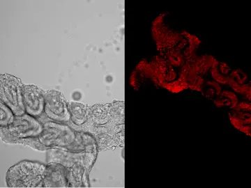 Embrión de Blattella germanica modificado genéticamente con DIPA-CRISPR Embrión de Blattella germanica modificado genéticamente con DIPA-CRISPR