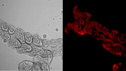 Embrión de Blattella germanica modificado genéticamente con DIPA-CRISPR Embrión de Blattella germanica modificado genéticamente con DIPA-CRISPR