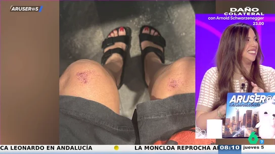 Tatiana Arús, sobre la foto de las rodillas de Heidi Klum tras su polémico vestido en los Globos de Oro: "La cosa está bastante mal" Tatiana Arús, sobre la foto de las rodillas de Heidi Klum tras su polémico vestido en los Globos de Oro: "La cosa está bastante mal"