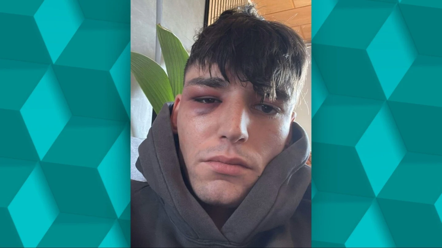 Brutal agresión homófoba a un árbitro alemán Brutal agresión homófoba a un árbitro alemán