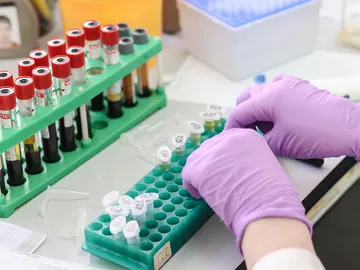 Laboratorio con muestras de sangre Laboratorio con muestras de sangre