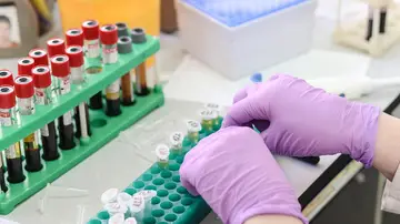 Laboratorio con muestras de sangre Laboratorio con muestras de sangre
