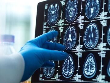 Esc&aacute;ner cerebral