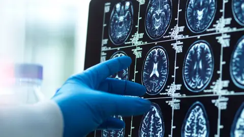 Escáner cerebral Escáner cerebral