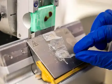 Científicos españoles desarrollan una solución para regenerar córneas con escamas de peces Científicos españoles desarrollan una solución para regenerar córneas con escamas de peces