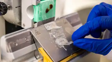 Científicos españoles desarrollan una solución para regenerar córneas con escamas de peces Científicos españoles desarrollan una solución para regenerar córneas con escamas de peces