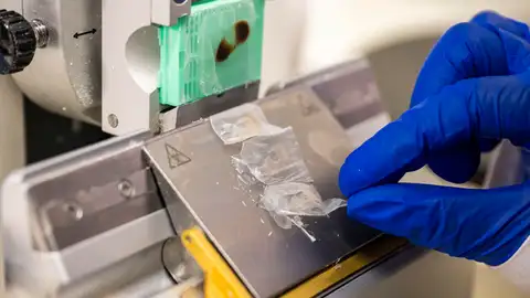 Científicos españoles desarrollan una solución para regenerar córneas con escamas de peces Científicos españoles desarrollan una solución para regenerar córneas con escamas de peces