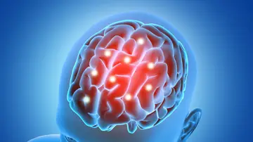 Representación en 3D de un cerebro Representación en 3D de un cerebro