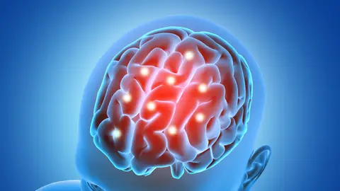 Representación en 3D de un cerebro Representación en 3D de un cerebro