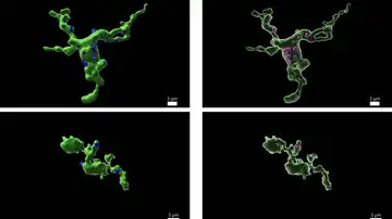 Exterior (izquierda) e interior (derecha) de las células de la microglía que interactúan con las neuronas GnRH. Los puntos azules de la izquierda representan las zonas de interacción, por las que la microglía absorbe fragmentos de neuronas GnRHA (lila, izquierda) Exterior (izquierda) e interior (derecha) de las células de la microglía que interactúan con las neuronas GnRH. Los puntos azules de la izquierda representan las zonas de interacción, por las que la microglía absorbe fragmentos de neuronas GnRHA (lila, izquierda)
