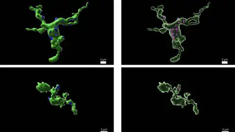 Exterior (izquierda) e interior (derecha) de las células de la microglía que interactúan con las neuronas GnRH. Los puntos azules de la izquierda representan las zonas de interacción, por las que la microglía absorbe fragmentos de neuronas GnRHA (lila, izquierda) Exterior (izquierda) e interior (derecha) de las células de la microglía que interactúan con las neuronas GnRH. Los puntos azules de la izquierda representan las zonas de interacción, por las que la microglía absorbe fragmentos de neuronas GnRHA (lila, izquierda)